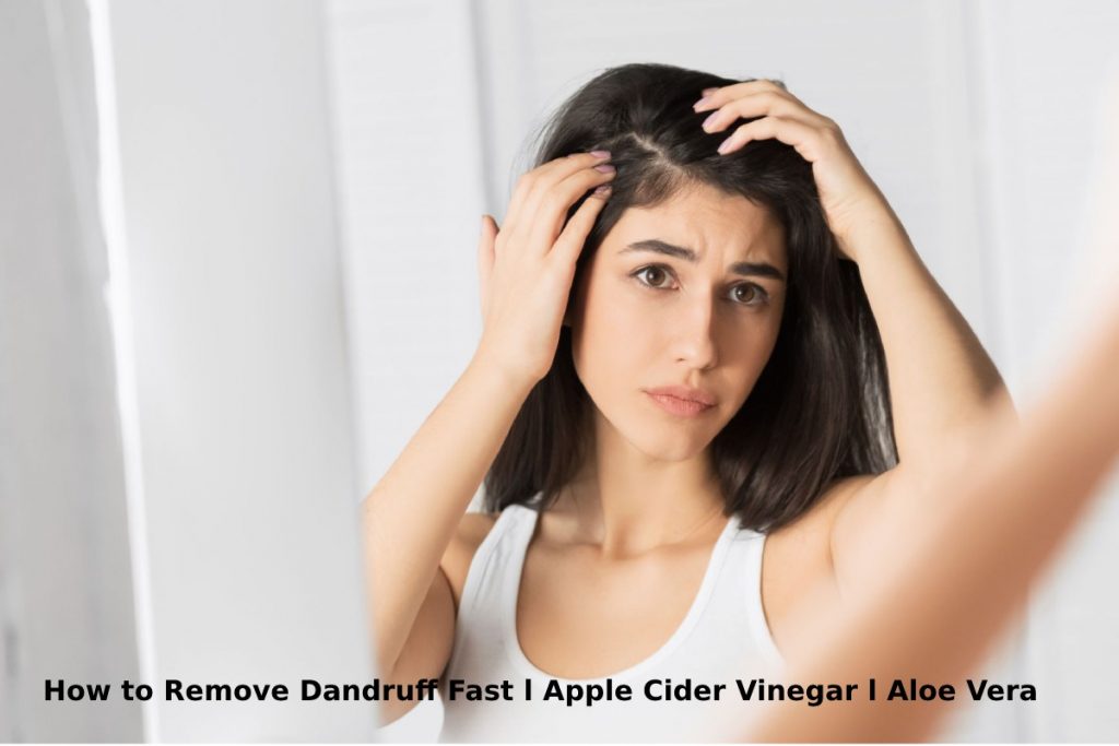 How to Remove Dandruff Fast