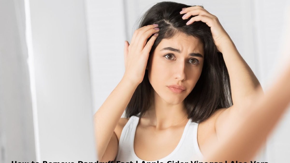 How to Remove Dandruff Fast