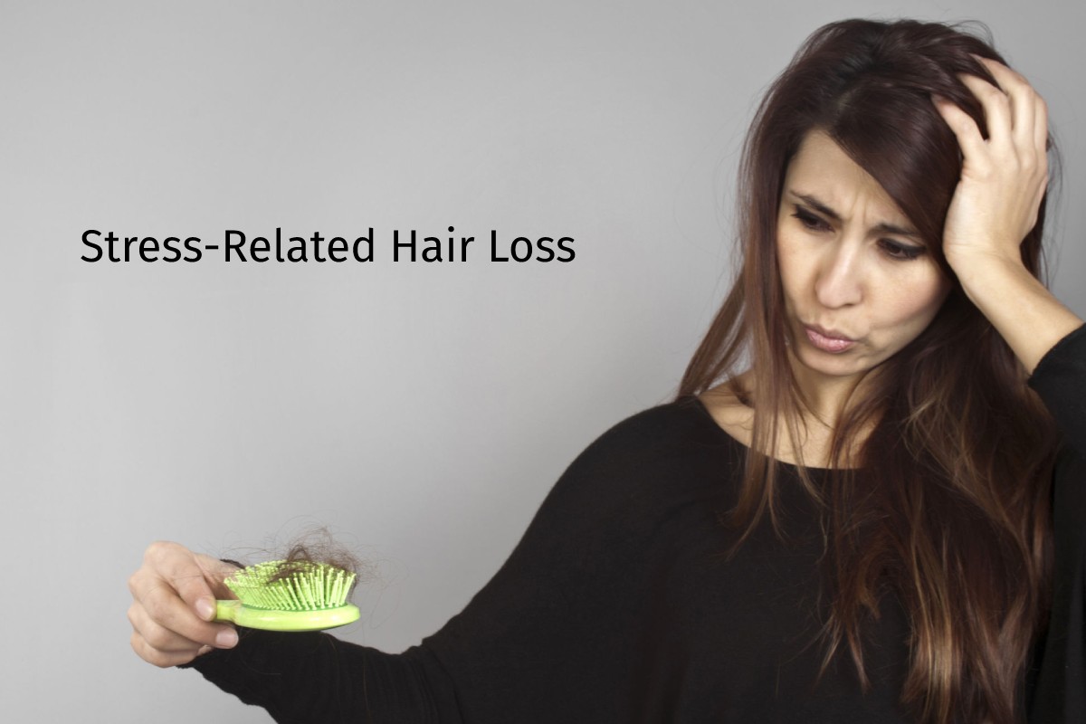 Is Stress Related Hair Loss Reversible Stress-Related Hair Loss – Types And Signs - 2022