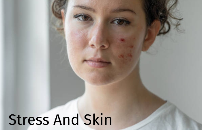 Skins Rashes Stress And Other Different Reasons In Allure