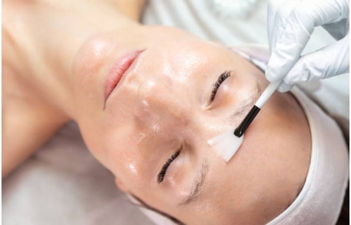 Points to Consider while doing a Skin Peel