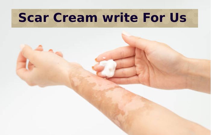 Scar Cream Write for Us