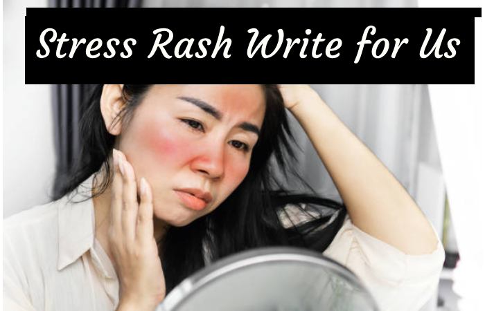 Stress Rash Write for Us