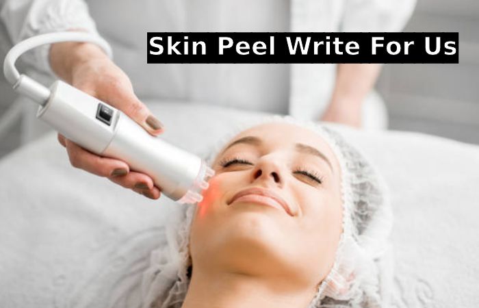 Why write for in allure- skin peel write for us (2)