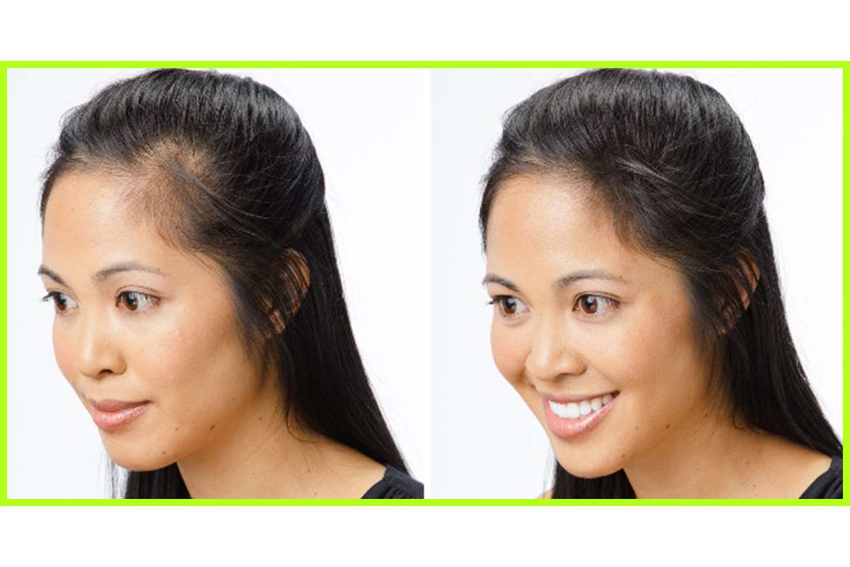 Shampoo for Hair Growth