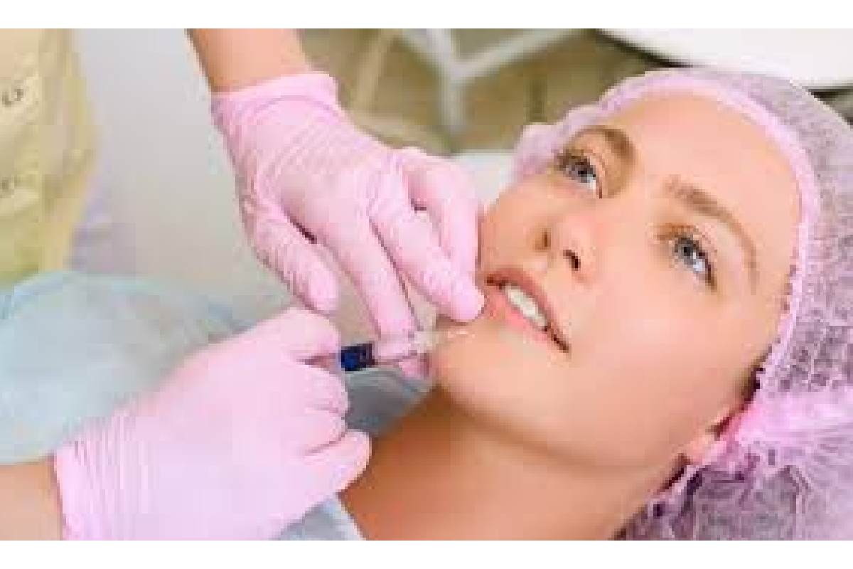 Wrinkle Filler