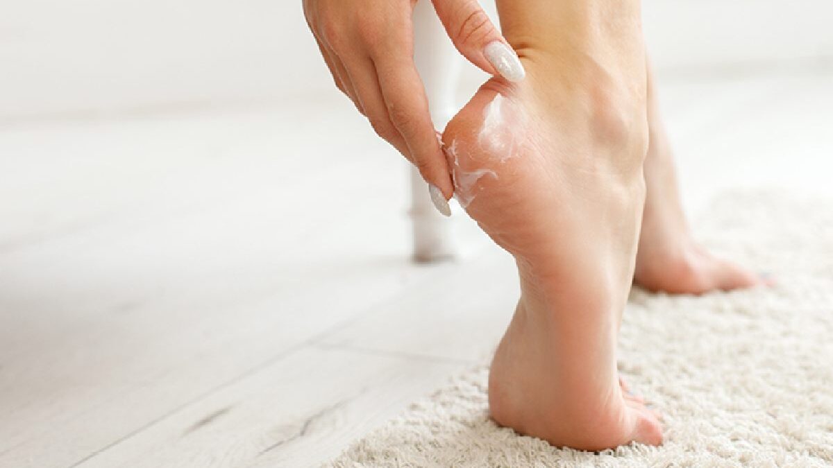 Introducing the Ultimate Heel Balm