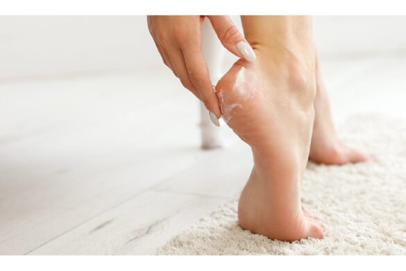 Introducing the Ultimate Heel Balm